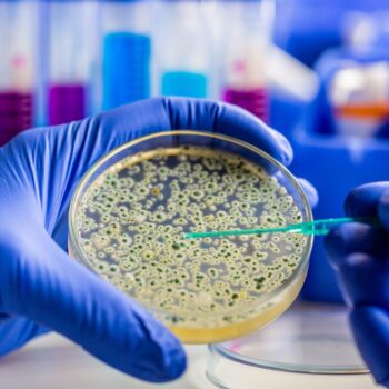 Hand in blauem Handschuh hält eine Petrischale mit Bakterienkolonien im Labor