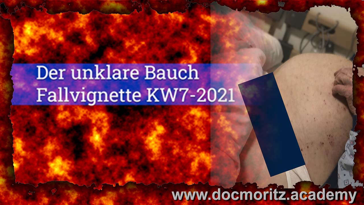 thumbnail bauch thumbnail bauch